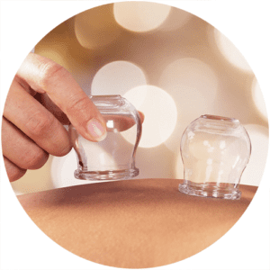 cupping-rotterdam
