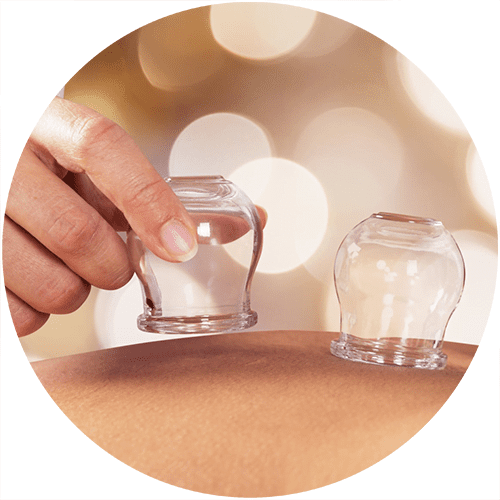 cupping-rotterdam